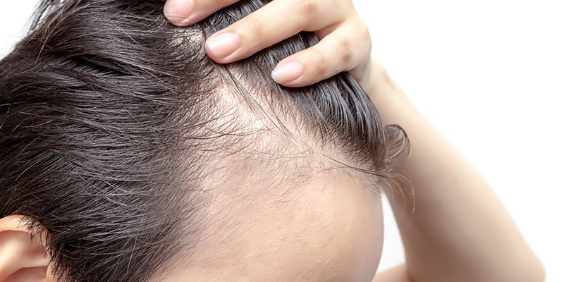 Hair Growth Products
